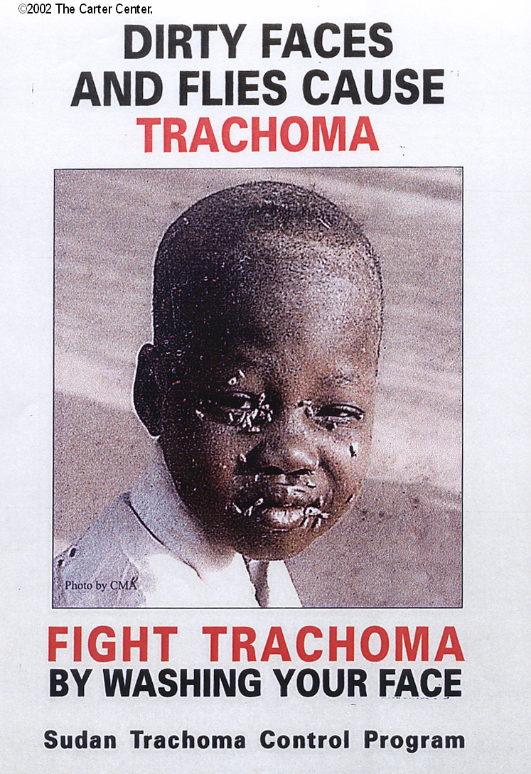 Trachoma Australia