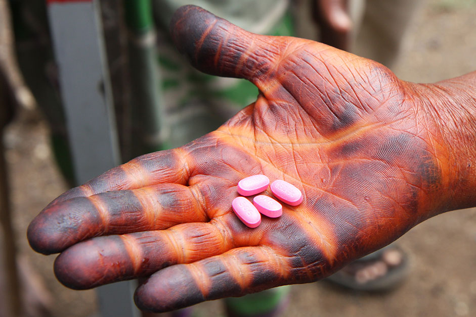 A local resident in Ethiopia holds an adult dose of the drug Zithroma.