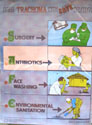 Fight Trachoma with the SAFE Strategy cover image