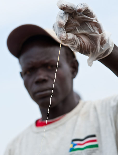 Guinea Worm Area Supervisor James Laki