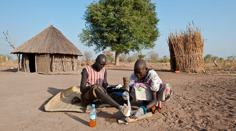 A woman cares for her husband's foot at their home in Senwei Village, South Sudan..