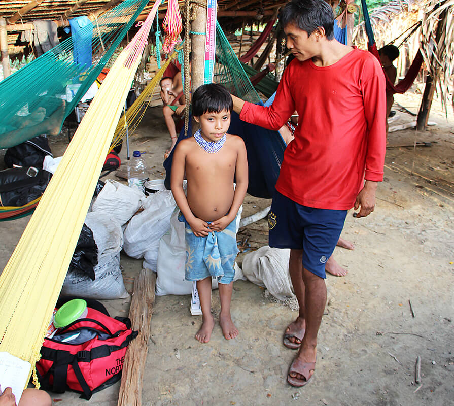  health worker measures a child for proper dosage of the medication that prevents river blindness.