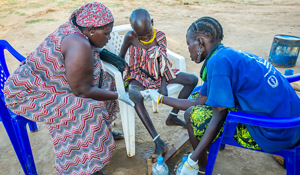 Educating people about Guinea worm prevention is vital to stopping the spread of the disease.
